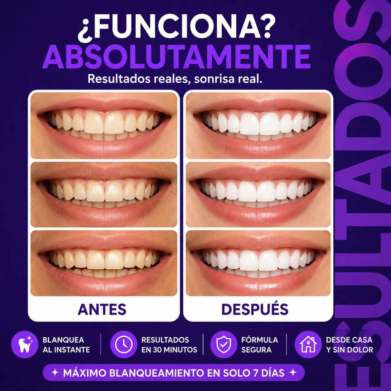 Tiras Blanqueadoras Moradas Smilekit